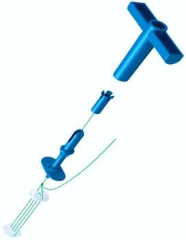 Feasibility and safety of one-stage sacral laminoplasty with autologous sacral laminar reimplantation fixed by absorbable fixation clamps in direct microsurgical treatment of symptomatic sacral extradural spinal meningeal cysts